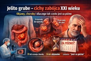 Rak jelita grubego i polipy a kolonoskopia